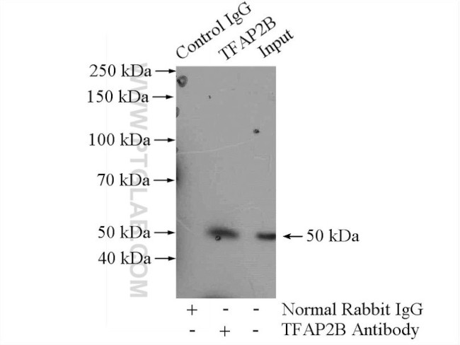 TFAP2B Antibody in Immunoprecipitation (IP)