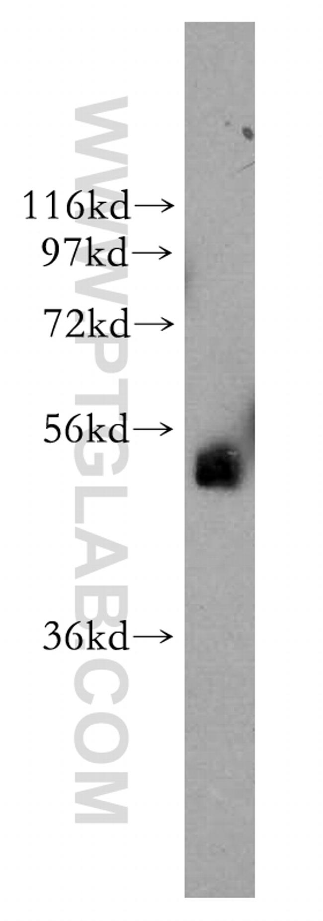 TFAP2B Antibody in Western Blot (WB)