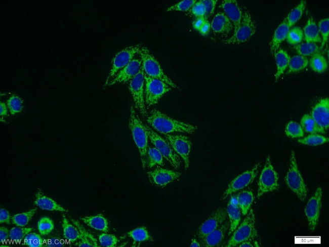 MLF1IP Antibody in Immunocytochemistry (ICC/IF)