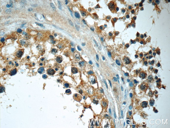 MLF1IP Antibody in Immunohistochemistry (Paraffin) (IHC (P))