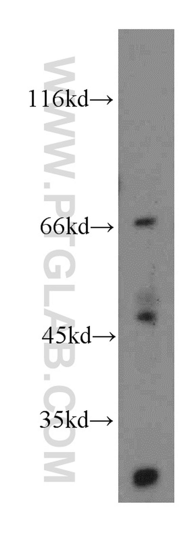 MLF1IP Antibody in Western Blot (WB)