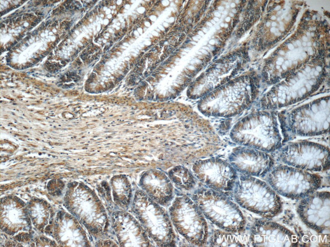 MLF1IP Antibody in Immunohistochemistry (Paraffin) (IHC (P))