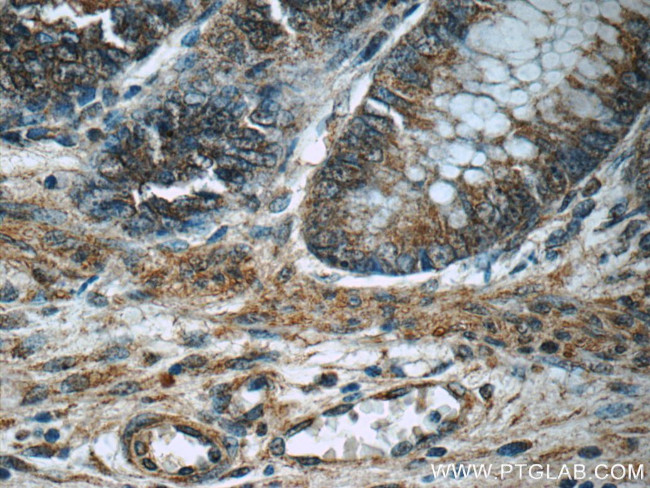 MLF1IP Antibody in Immunohistochemistry (Paraffin) (IHC (P))