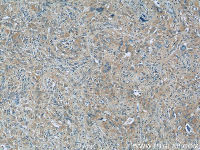 MLF1IP Antibody in Immunohistochemistry (Paraffin) (IHC (P))