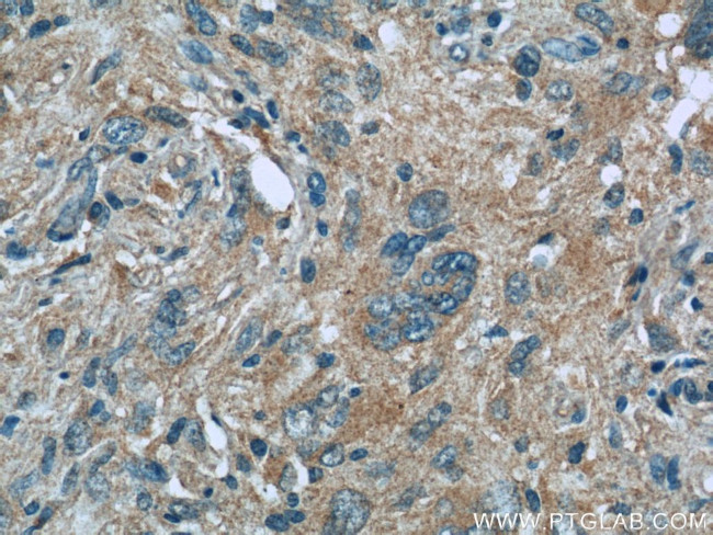 MLF1IP Antibody in Immunohistochemistry (Paraffin) (IHC (P))