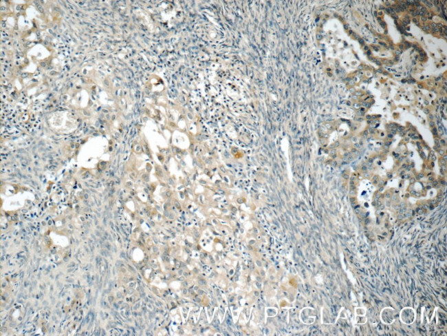 RAB25 Antibody in Immunohistochemistry (Paraffin) (IHC (P))