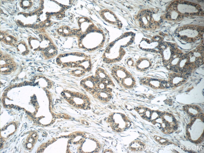 RAB25 Antibody in Immunohistochemistry (Paraffin) (IHC (P))