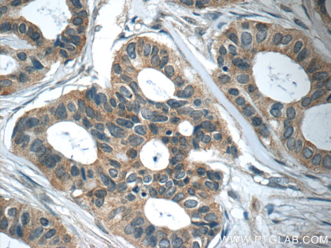 RAB25 Antibody in Immunohistochemistry (Paraffin) (IHC (P))