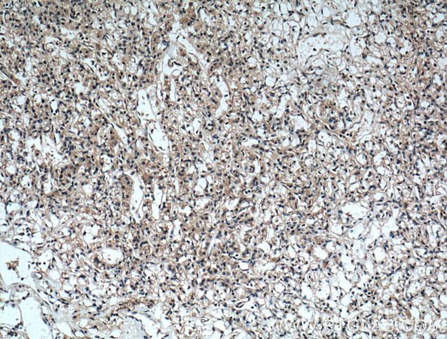 RAB25 Antibody in Immunohistochemistry (Paraffin) (IHC (P))