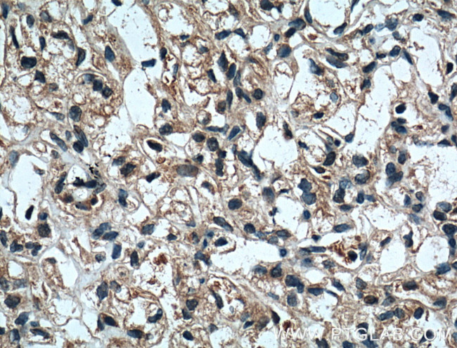 RAB25 Antibody in Immunohistochemistry (Paraffin) (IHC (P))