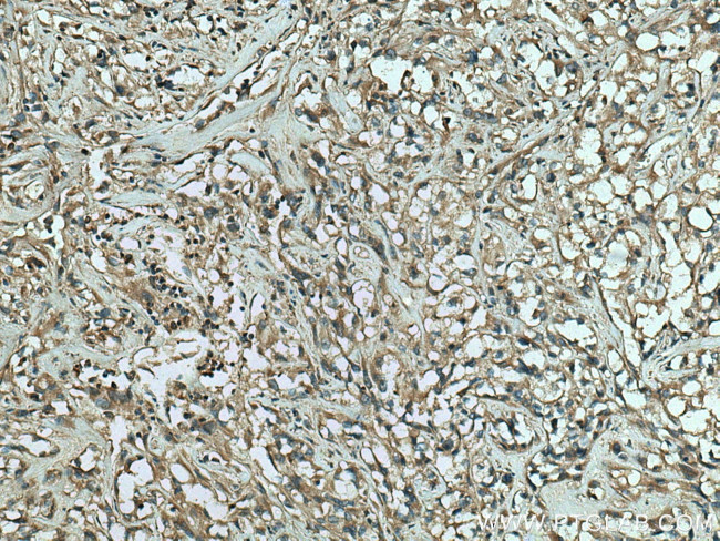 RAB25 Antibody in Immunohistochemistry (Paraffin) (IHC (P))