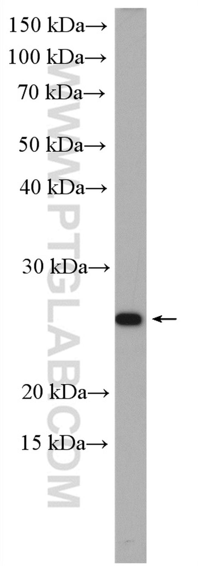 RAB25 Antibody in Western Blot (WB)