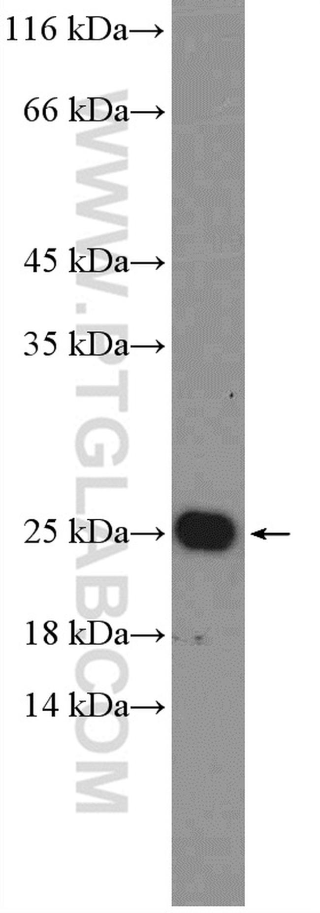 RAB25 Antibody in Western Blot (WB)