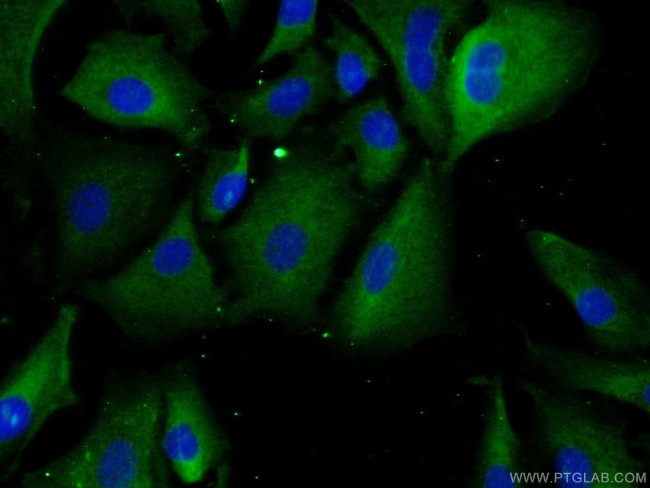 SAA2 Antibody in Immunocytochemistry (ICC/IF)