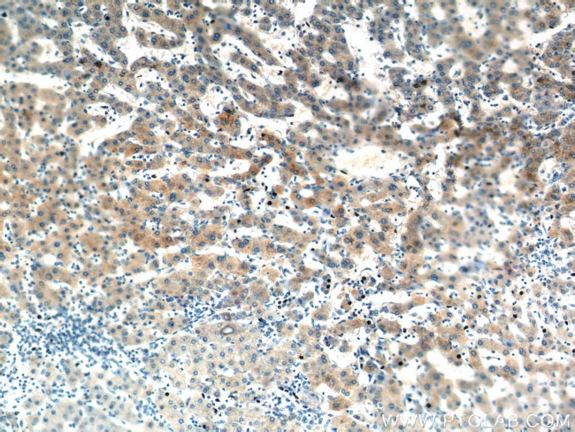 SAA2 Antibody in Immunohistochemistry (Paraffin) (IHC (P))