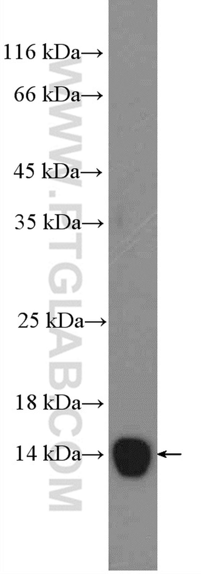 SAA2 Antibody in Western Blot (WB)