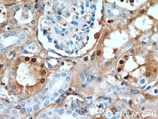 FXR1 Antibody in Immunohistochemistry (Paraffin) (IHC (P))