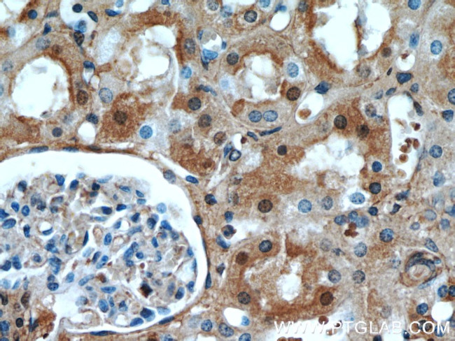 FXR1 Antibody in Immunohistochemistry (Paraffin) (IHC (P))