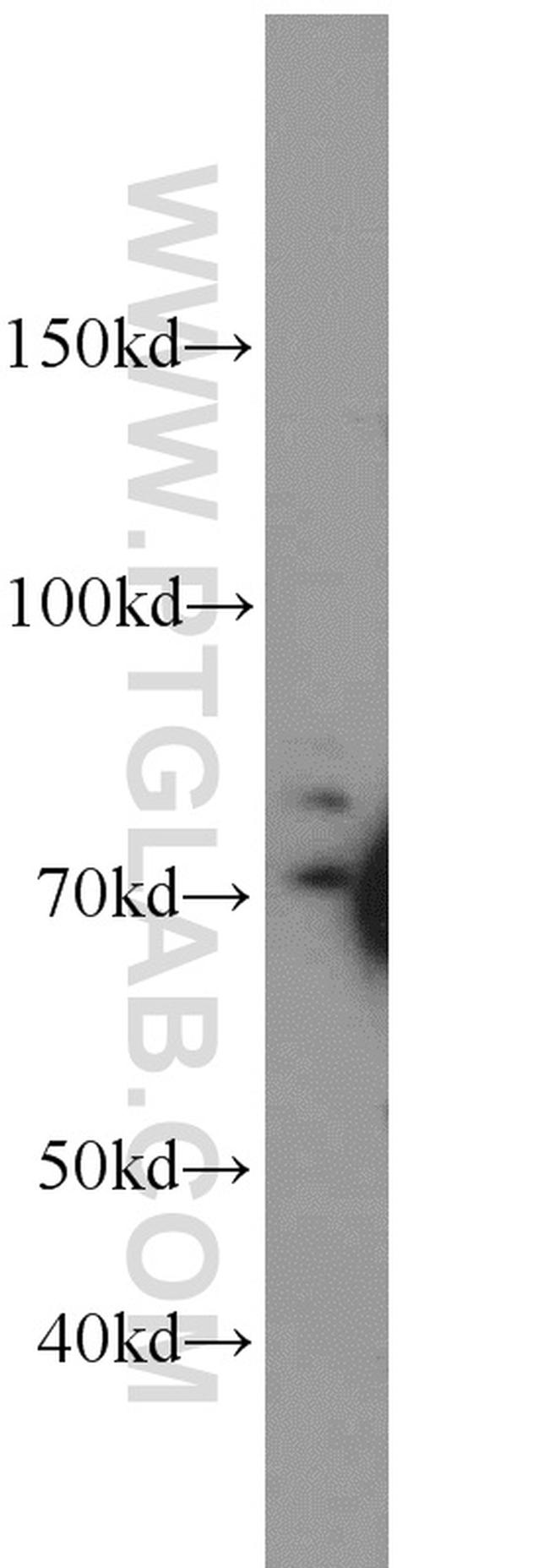 FXR1 Antibody in Western Blot (WB)