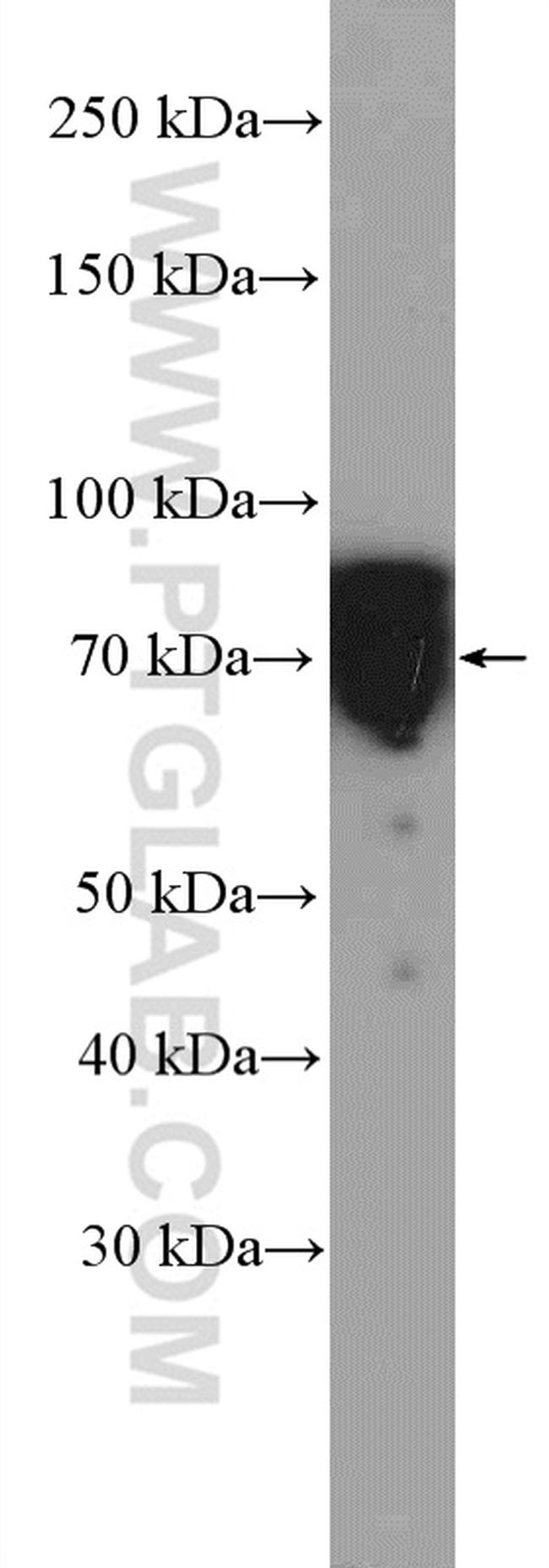 FXR1 Antibody in Western Blot (WB)