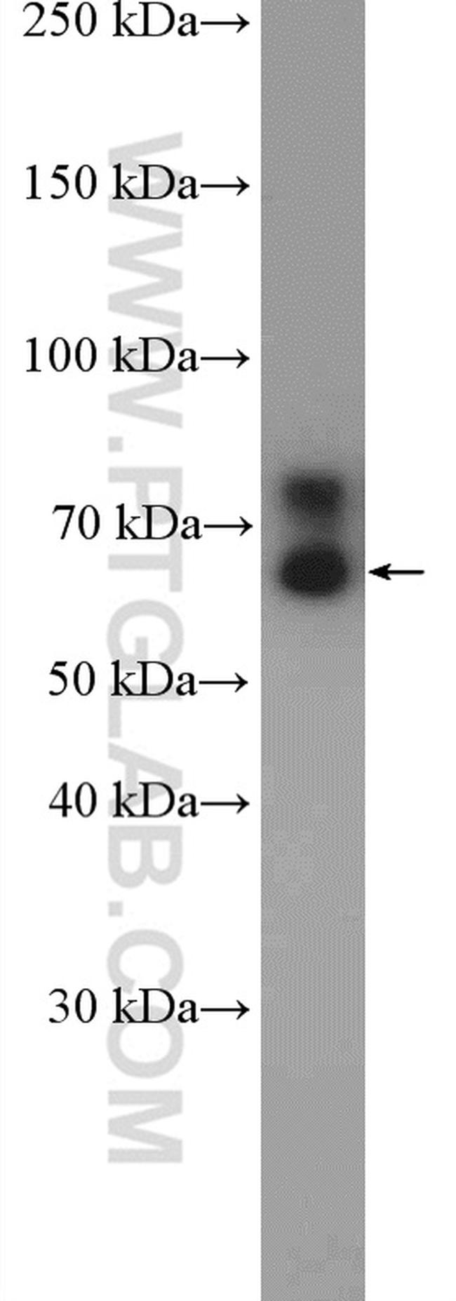 FXR1 Antibody in Western Blot (WB)