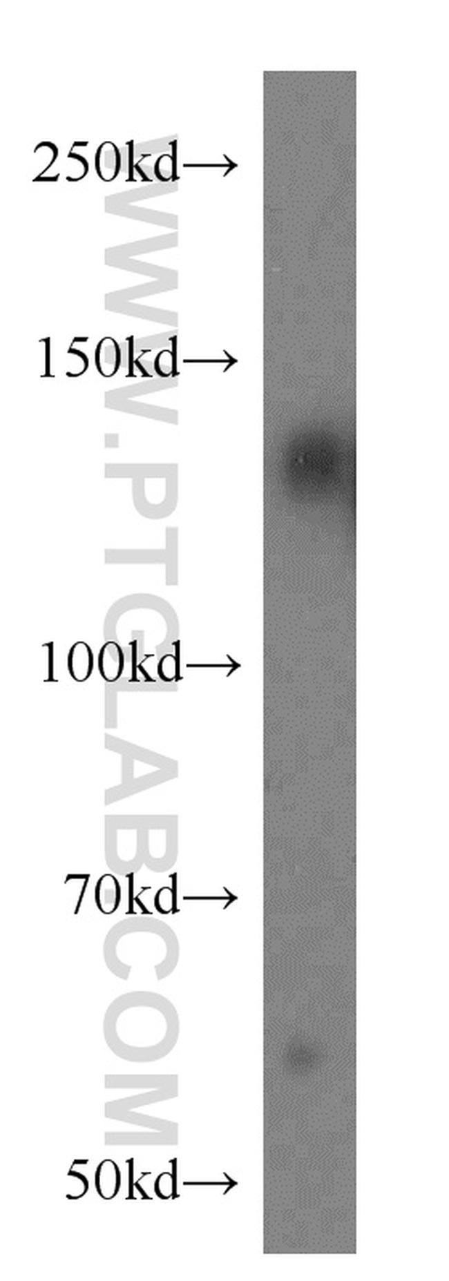 AXL Antibody in Western Blot (WB)