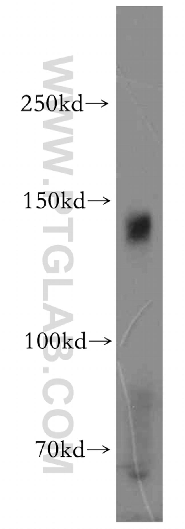 AXL Antibody in Western Blot (WB)