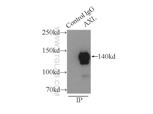 AXL Antibody in Immunoprecipitation (IP)