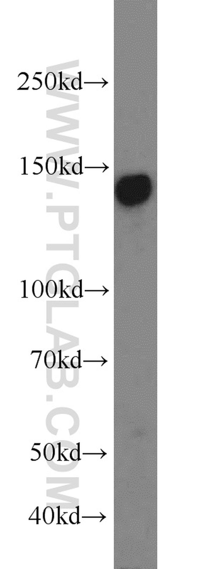 AXL Antibody in Western Blot (WB)