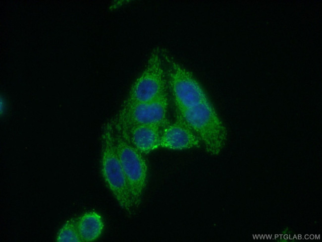 DCLRE1B Antibody in Immunocytochemistry (ICC/IF)