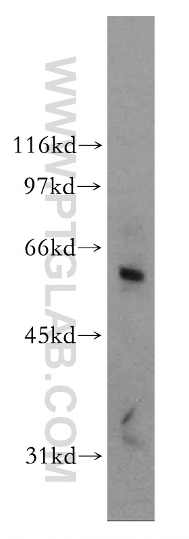 DCLRE1B Antibody in Western Blot (WB)