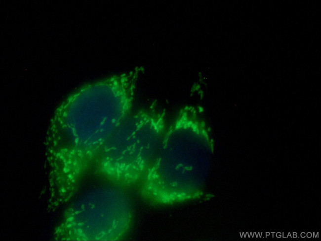 AK3L1 Antibody in Immunocytochemistry (ICC/IF)