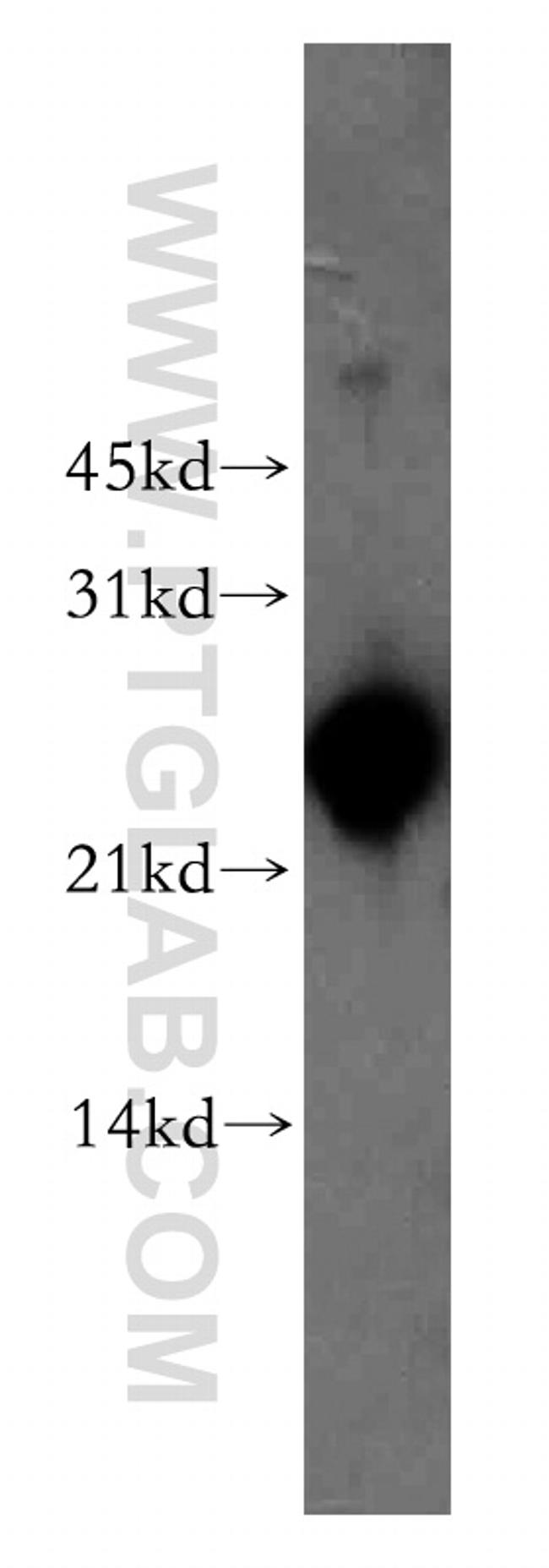 AK3L1 Antibody in Western Blot (WB)