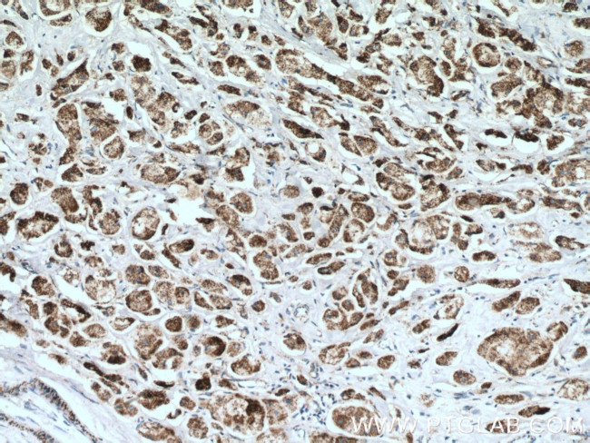 AK3L1 Antibody in Immunohistochemistry (Paraffin) (IHC (P))