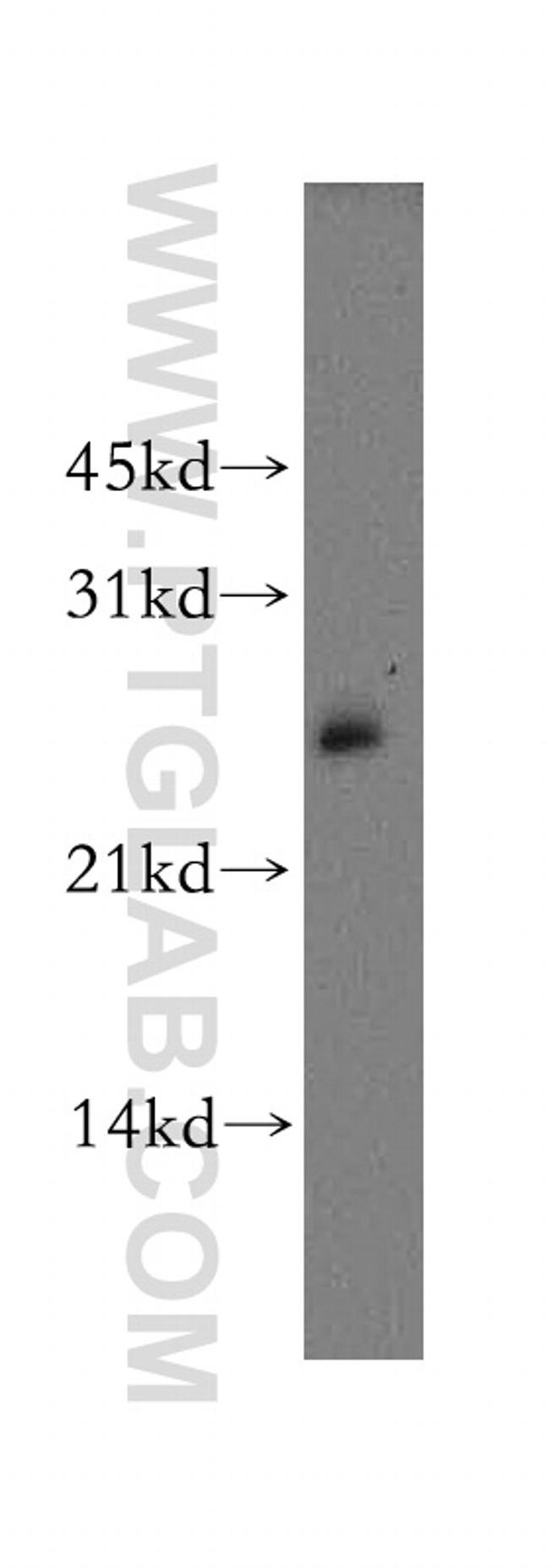 AK3L1 Antibody in Western Blot (WB)