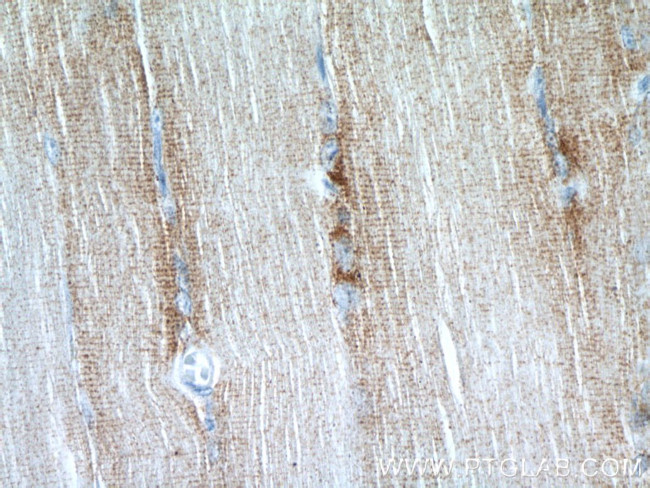 CKMT2 Antibody in Immunohistochemistry (Paraffin) (IHC (P))