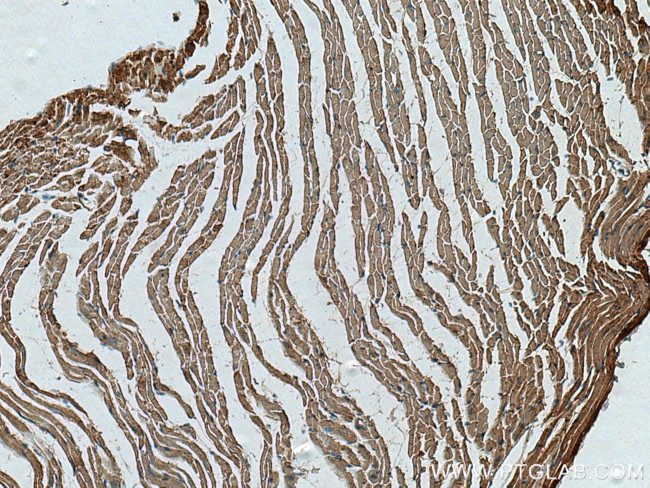 CKMT2 Antibody in Immunohistochemistry (Paraffin) (IHC (P))