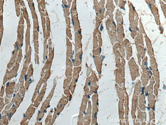 CKMT2 Antibody in Immunohistochemistry (Paraffin) (IHC (P))