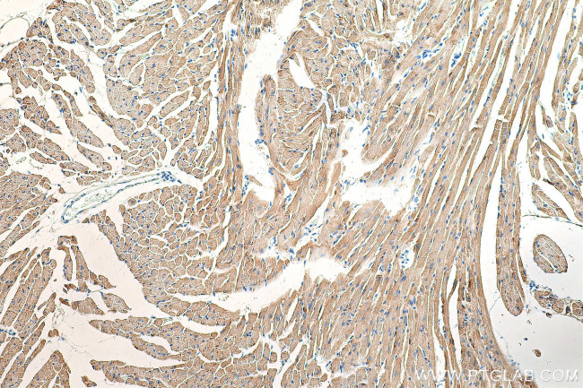 CKMT2 Antibody in Immunohistochemistry (Paraffin) (IHC (P))