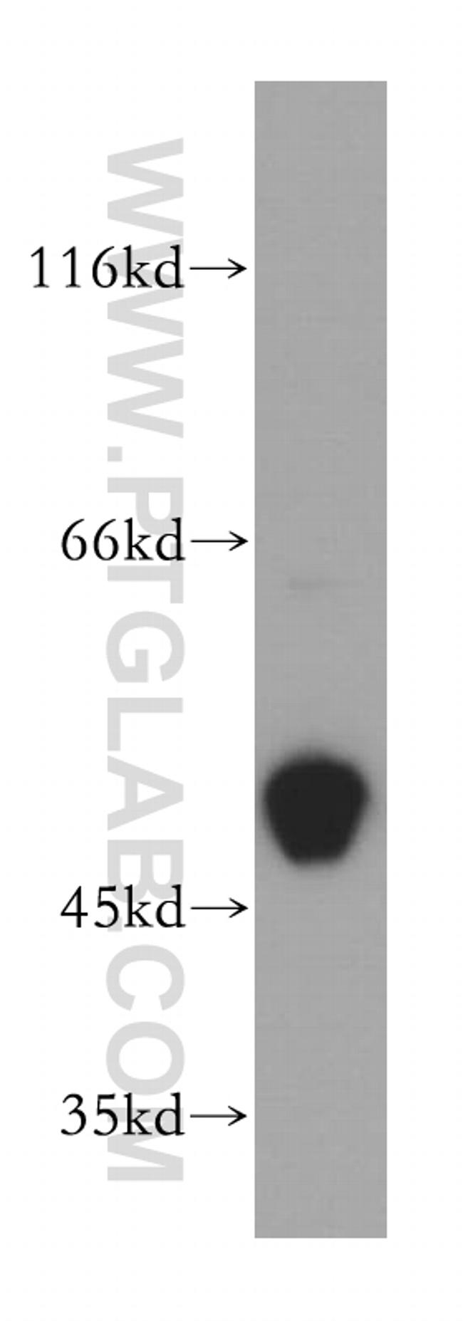 CKMT2 Antibody in Western Blot (WB)