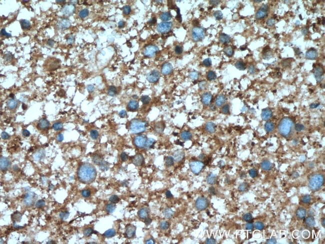 PPP3R1 Antibody in Immunohistochemistry (Paraffin) (IHC (P))