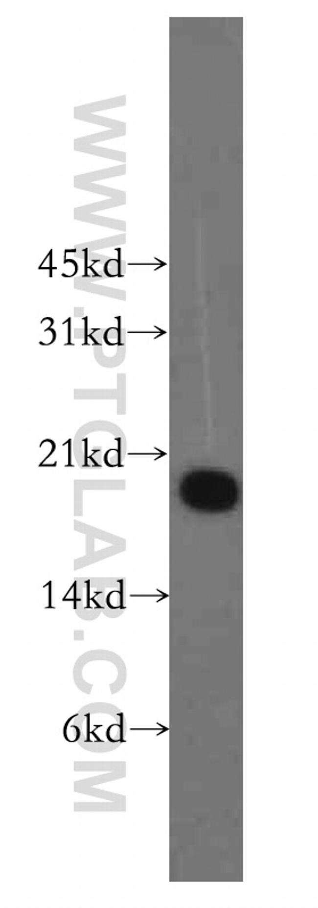 PPP3R1 Antibody in Western Blot (WB)