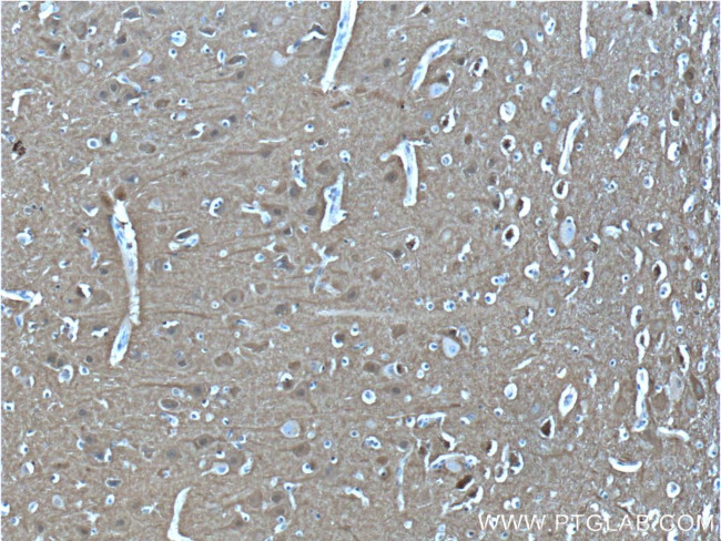 PPP3R1 Antibody in Immunohistochemistry (Paraffin) (IHC (P))