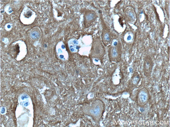 PPP3R1 Antibody in Immunohistochemistry (Paraffin) (IHC (P))