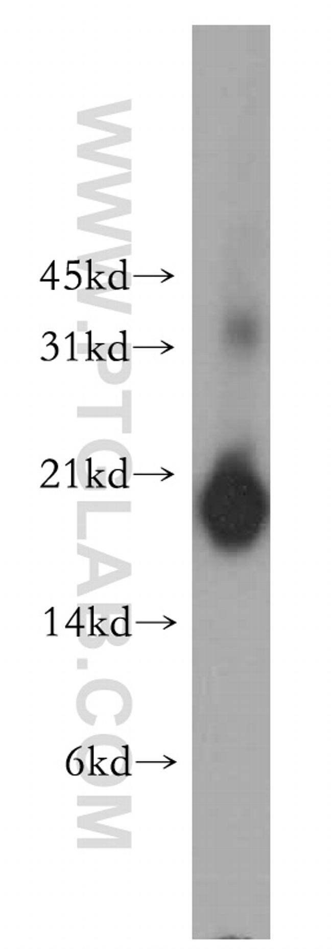 PPP3R1 Antibody in Western Blot (WB)