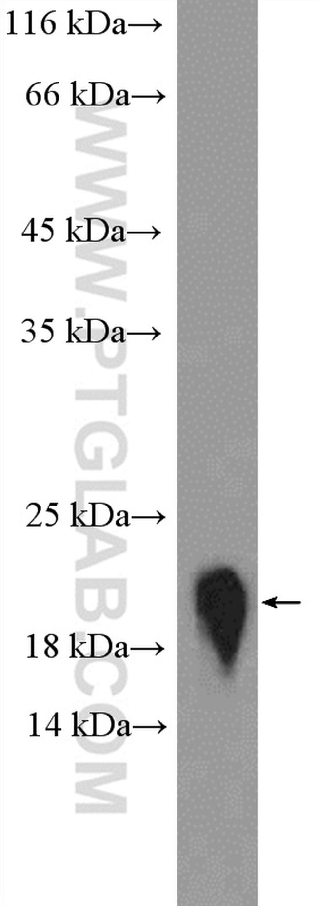 PPP3R1 Antibody in Western Blot (WB)