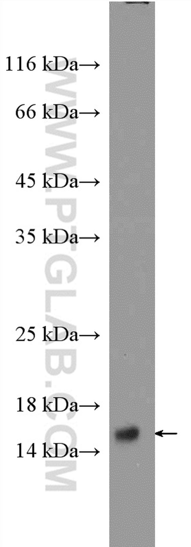 PPP3R1 Antibody in Western Blot (WB)