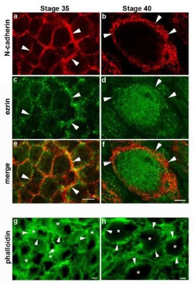 N-cadherin Antibody in Immunocytochemistry (ICC/IF)