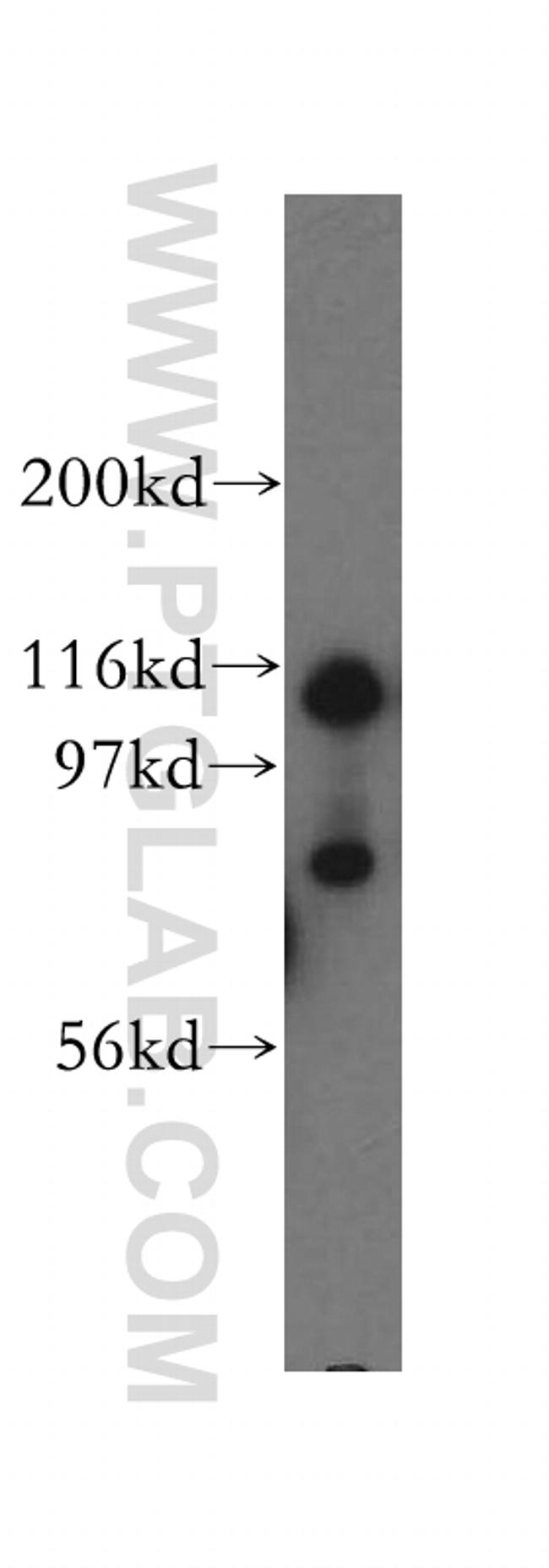 UBA6 Antibody in Western Blot (WB)