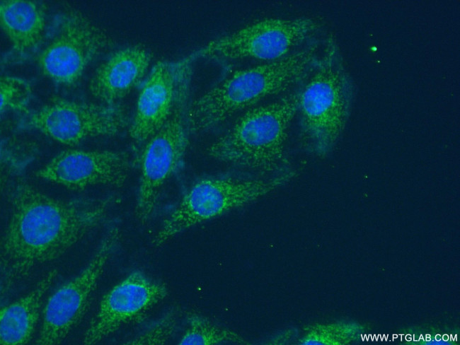 UBA6 Antibody in Immunocytochemistry (ICC/IF)